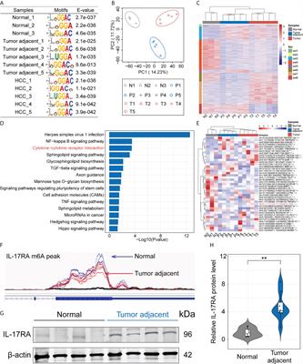 FTO promotes liver inflammation by suppressing m6A mRNA methylation of IL-17RA